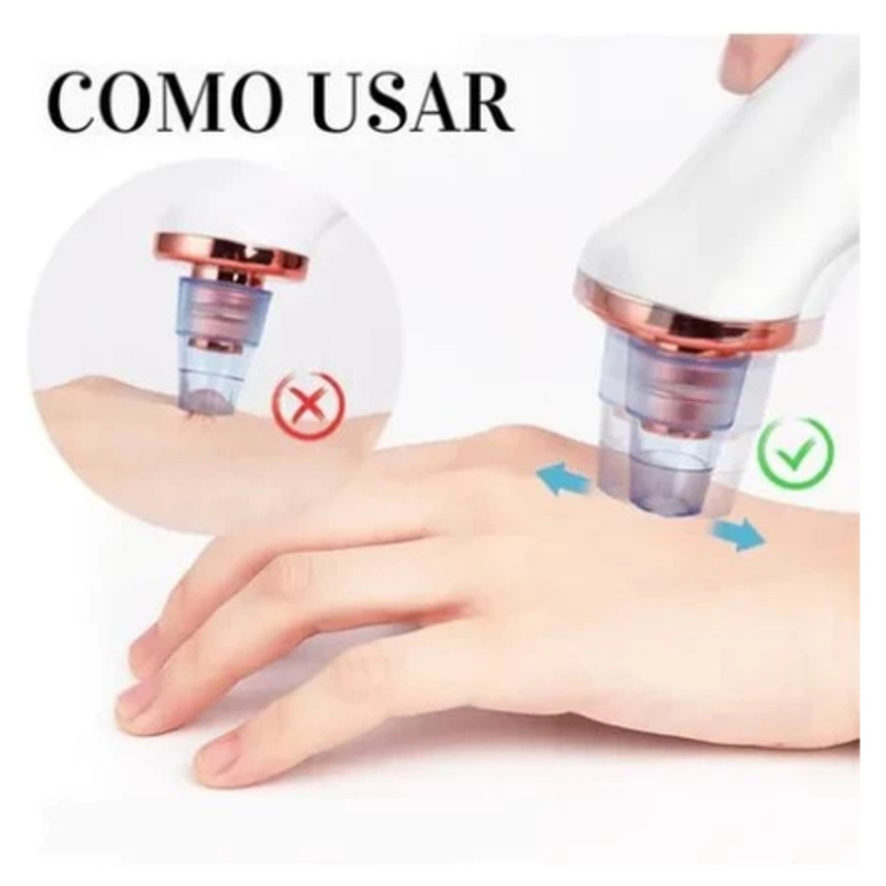 Removedor De Cravos Espinhas Cleaning Sugador Poros Acne Sucção Usb Recarregável