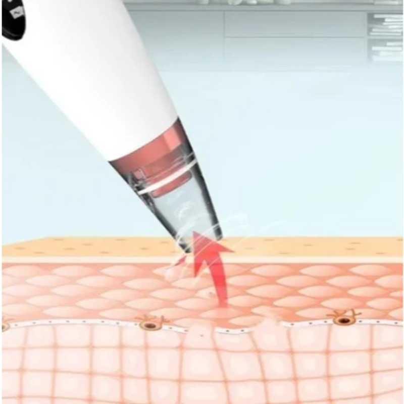 Removedor De Cravos Espinhas Cleaning Sugador Poros Acne Sucção Usb Recarregável